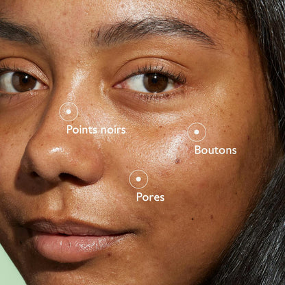 Sérum à l'Acide Salicylique Anti-imperfections