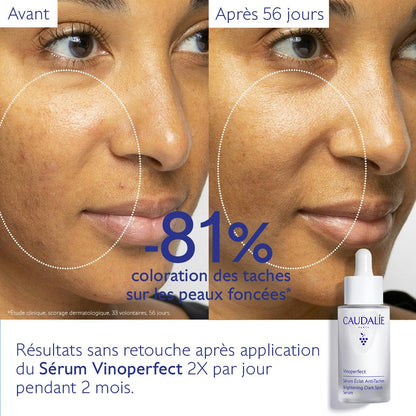 Sérum Éclat Anti-Taches à la Viniférine, alternative à la Vitamine C - 30ml